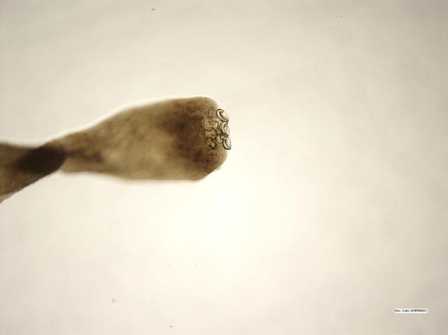 scolex cestod